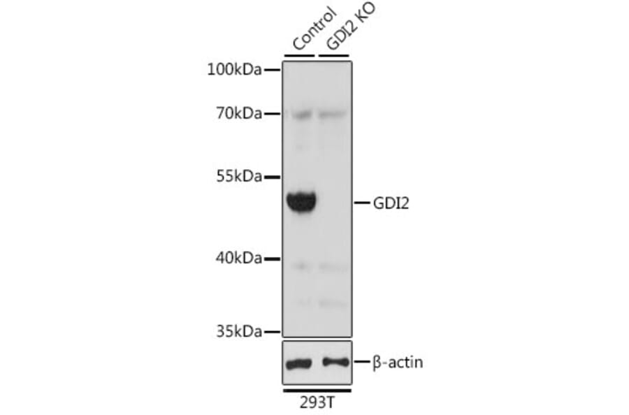 Western Blot - Anti-GDI2 Antibody (A16249) - Antibodies.com