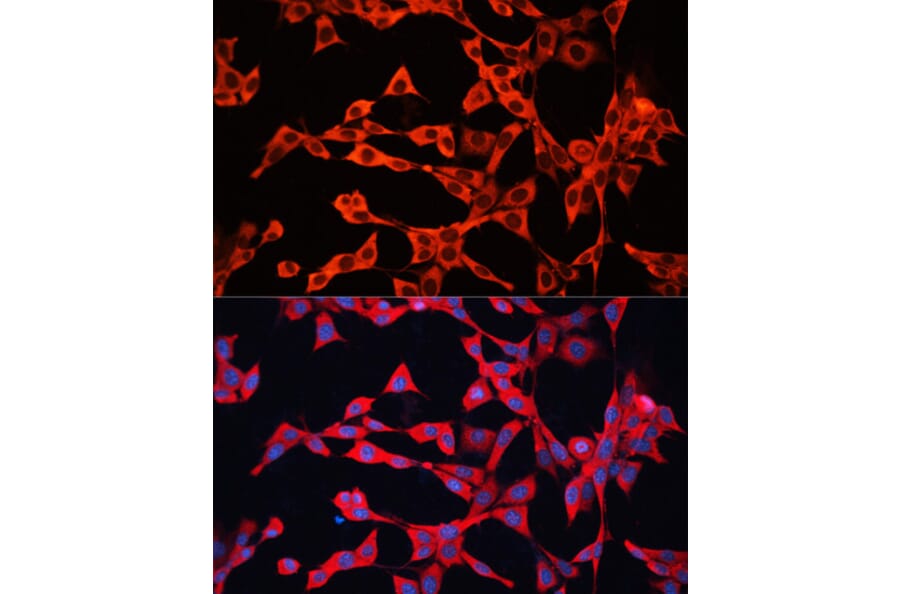 Immunofluorescence - Anti-GDI2 Antibody (A16249) - Antibodies.com