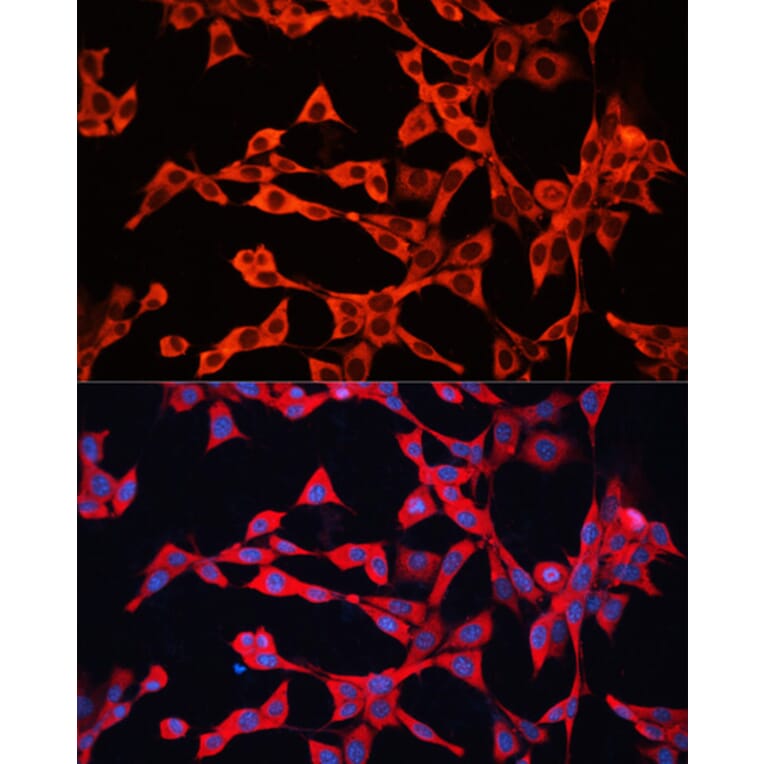 Immunofluorescence - Anti-GDI2 Antibody (A16249) - Antibodies.com