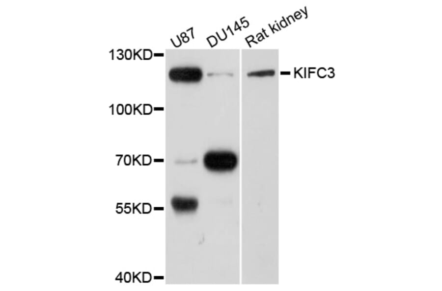 Western Blot - Anti-KIFC3 Antibody (A8617) - Antibodies.com