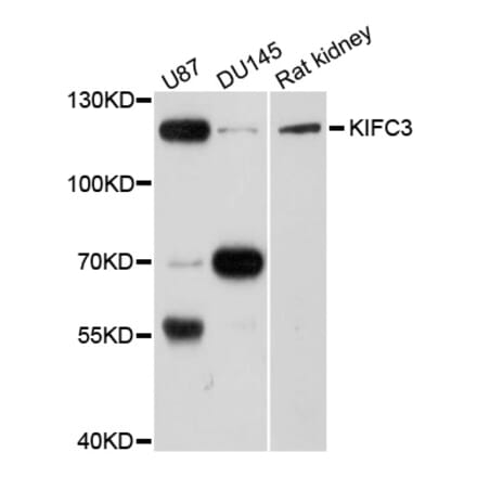 Western Blot - Anti-KIFC3 Antibody (A8617) - Antibodies.com