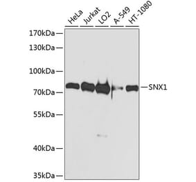 Western Blot - Anti-SNX1 Antibody (A16251) - Antibodies.com