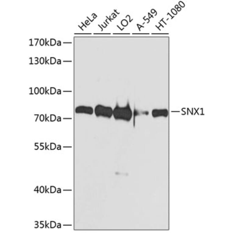 Western Blot - Anti-SNX1 Antibody (A16251) - Antibodies.com