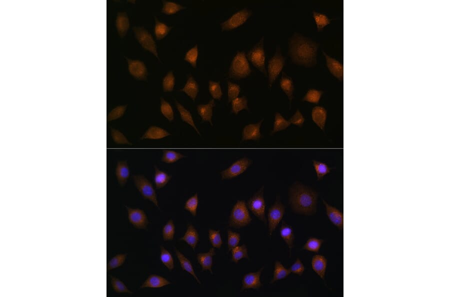 Immunofluorescence - Anti-SNX1 Antibody (A16251) - Antibodies.com