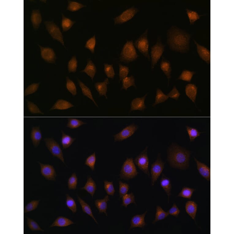 Immunofluorescence - Anti-SNX1 Antibody (A16251) - Antibodies.com