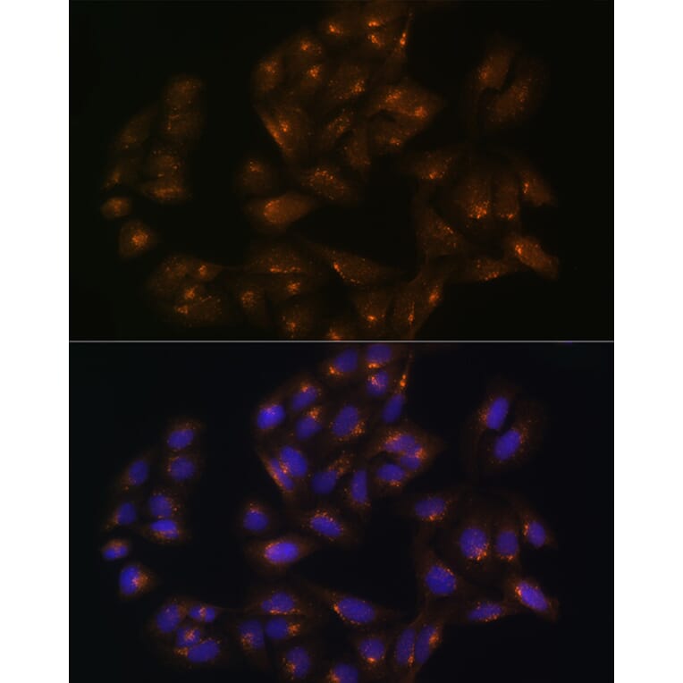 Immunofluorescence - Anti-SNX1 Antibody (A16251) - Antibodies.com