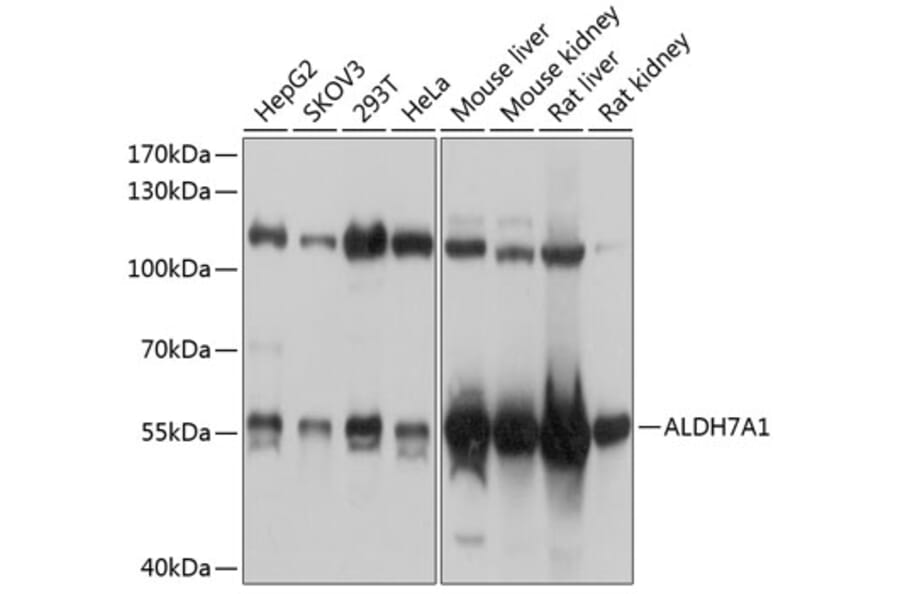 Western Blot - Anti-ALDH7A1 Antibody (A16252) - Antibodies.com