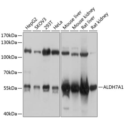 Western Blot - Anti-ALDH7A1 Antibody (A16252) - Antibodies.com