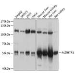 Western Blot - Anti-ALDH7A1 Antibody (A16252) - Antibodies.com