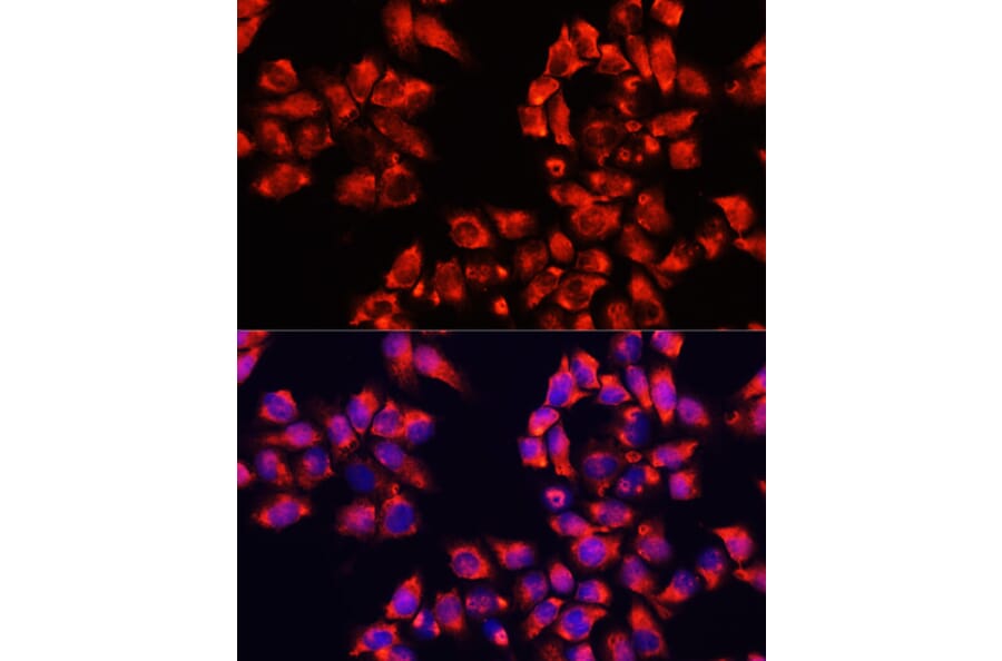 Immunofluorescence - Anti-ALDH7A1 Antibody (A16252) - Antibodies.com