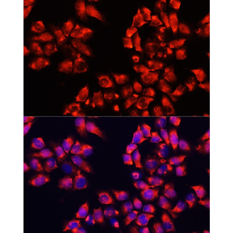 Immunofluorescence - Anti-ALDH7A1 Antibody (A16252) - Antibodies.com