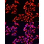 Immunofluorescence - Anti-ALDH7A1 Antibody (A16252) - Antibodies.com