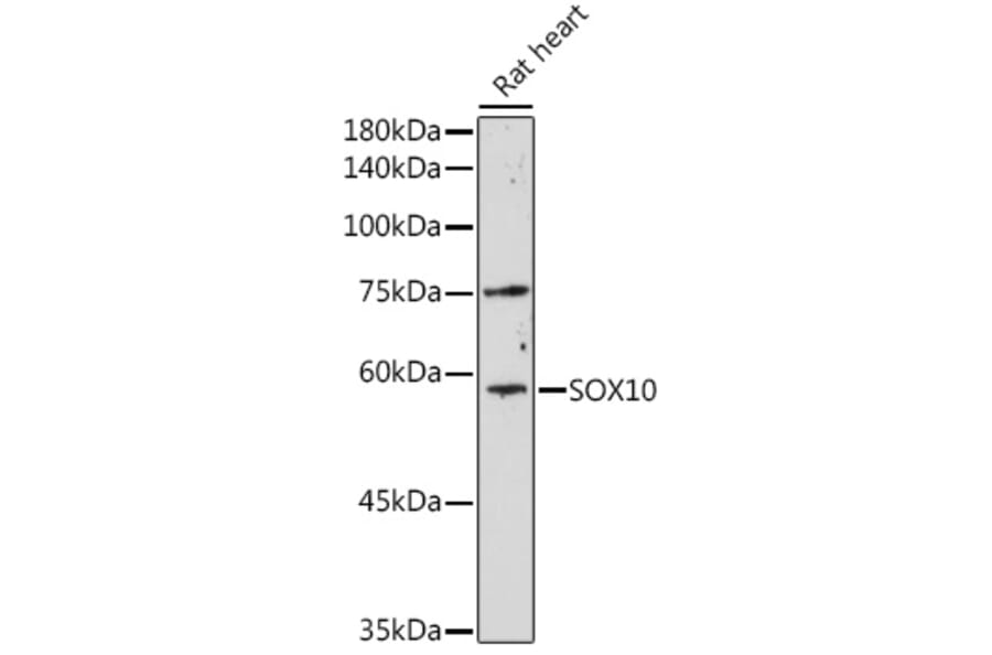 Western Blot - Anti-SOX10 Antibody (A16253) - Antibodies.com