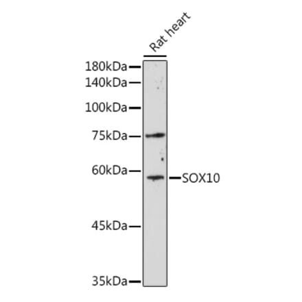 Western Blot - Anti-SOX10 Antibody (A16253) - Antibodies.com