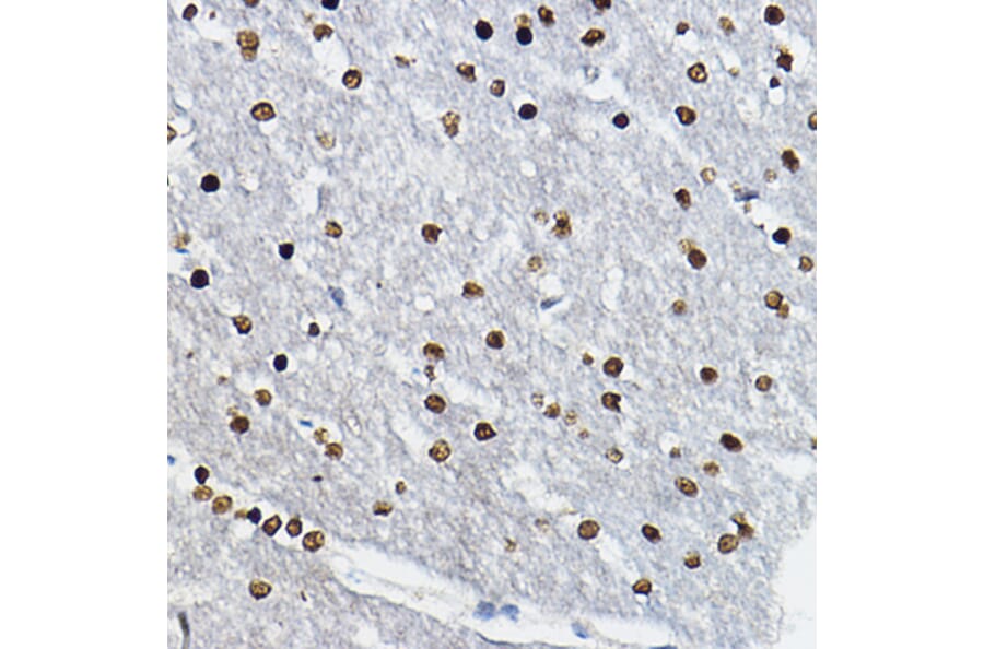 Immunohistochemistry - Anti-SOX10 Antibody (A16253) - Antibodies.com
