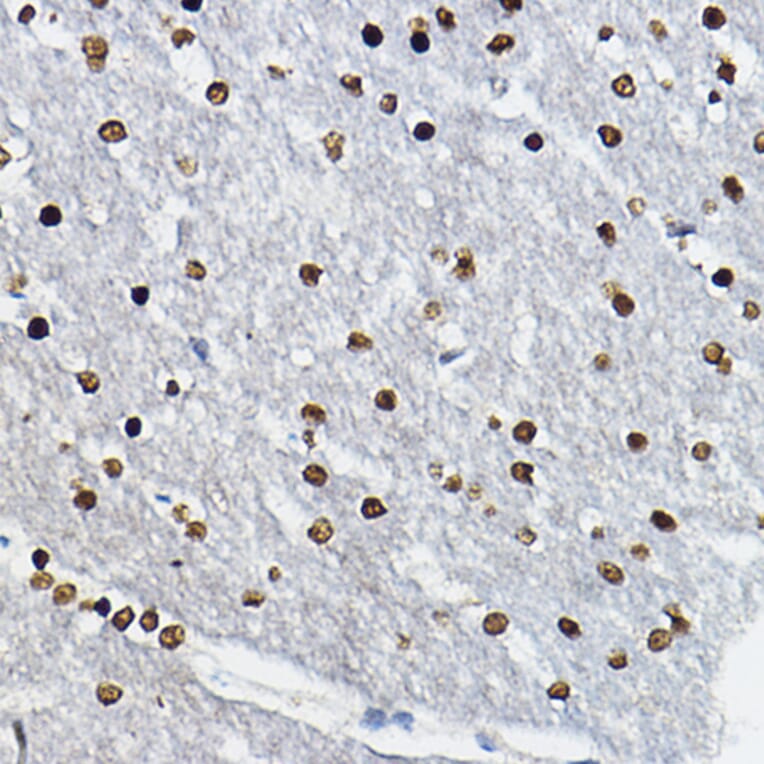 Immunohistochemistry - Anti-SOX10 Antibody (A16253) - Antibodies.com