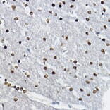 Immunohistochemistry - Anti-SOX10 Antibody (A16253) - Antibodies.com