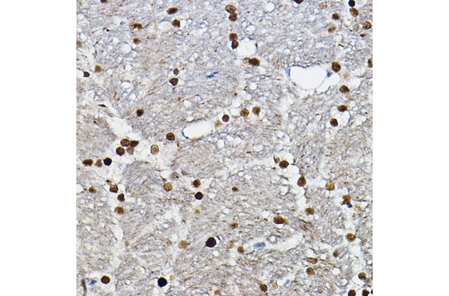 Immunohistochemistry - Anti-SOX10 Antibody (A16253) - Antibodies.com