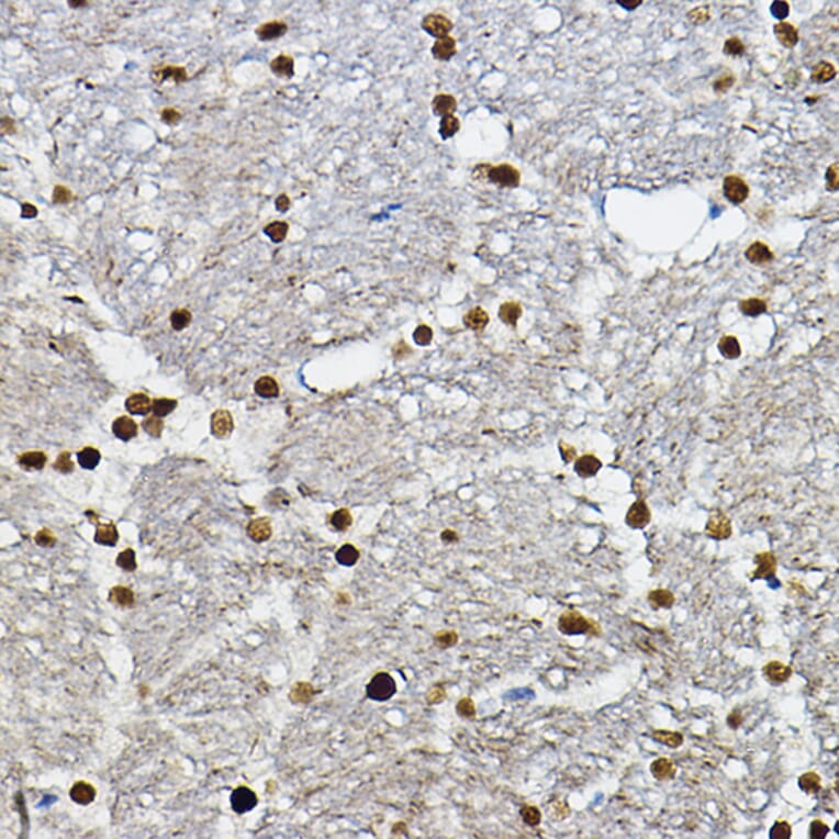 Immunohistochemistry - Anti-SOX10 Antibody (A16253) - Antibodies.com