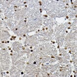 Immunohistochemistry - Anti-SOX10 Antibody (A16253) - Antibodies.com