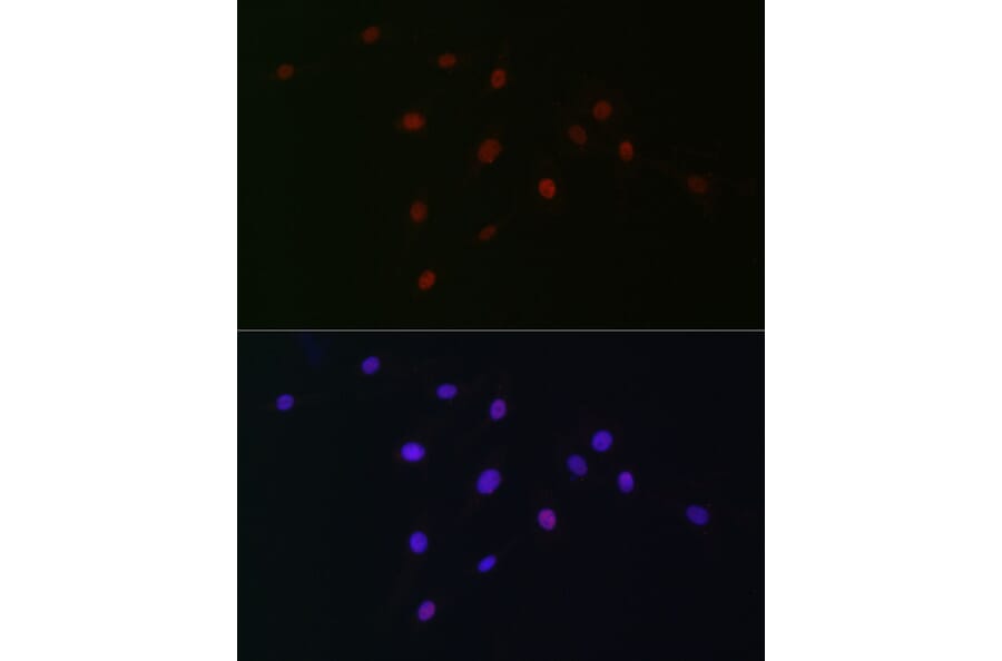 Immunofluorescence - Anti-SOX10 Antibody (A16253) - Antibodies.com