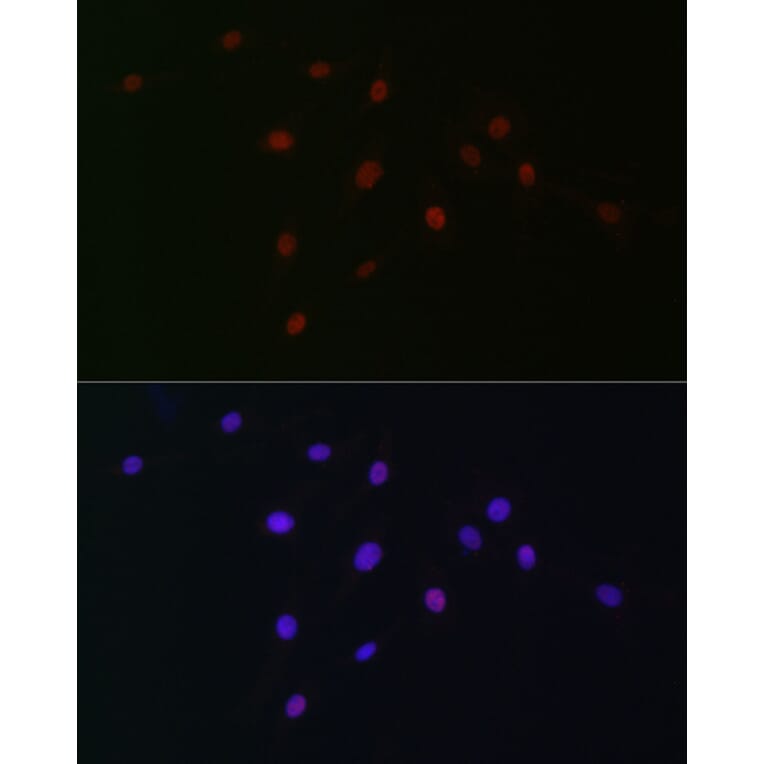 Immunofluorescence - Anti-SOX10 Antibody (A16253) - Antibodies.com