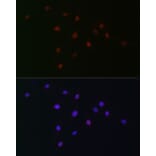 Immunofluorescence - Anti-SOX10 Antibody (A16253) - Antibodies.com