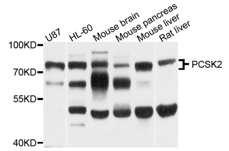 Western Blot - Anti-PCSK2 Antibody (A8644) - Antibodies.com
