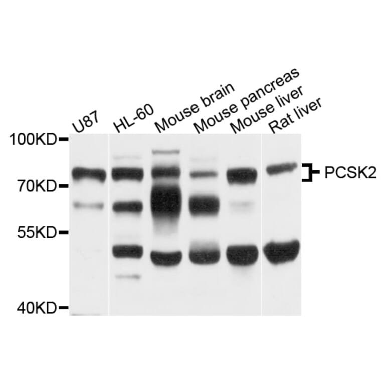 Western Blot - Anti-PCSK2 Antibody (A8644) - Antibodies.com