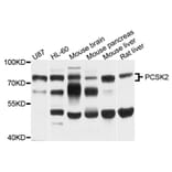 Western Blot - Anti-PCSK2 Antibody (A8644) - Antibodies.com