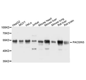 Western Blot - Anti-PACSIN3 Antibody (A8647) - Antibodies.com
