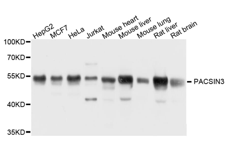 Western Blot - Anti-PACSIN3 Antibody (A8647) - Antibodies.com
