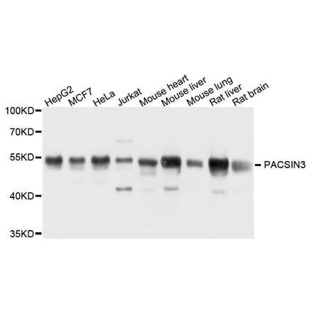 Western Blot - Anti-PACSIN3 Antibody (A16255) - Antibodies.com