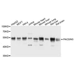 Western Blot - Anti-PACSIN3 Antibody (A8647) - Antibodies.com