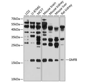 Western Blot - Anti-GMFB Antibody (A16256) - Antibodies.com