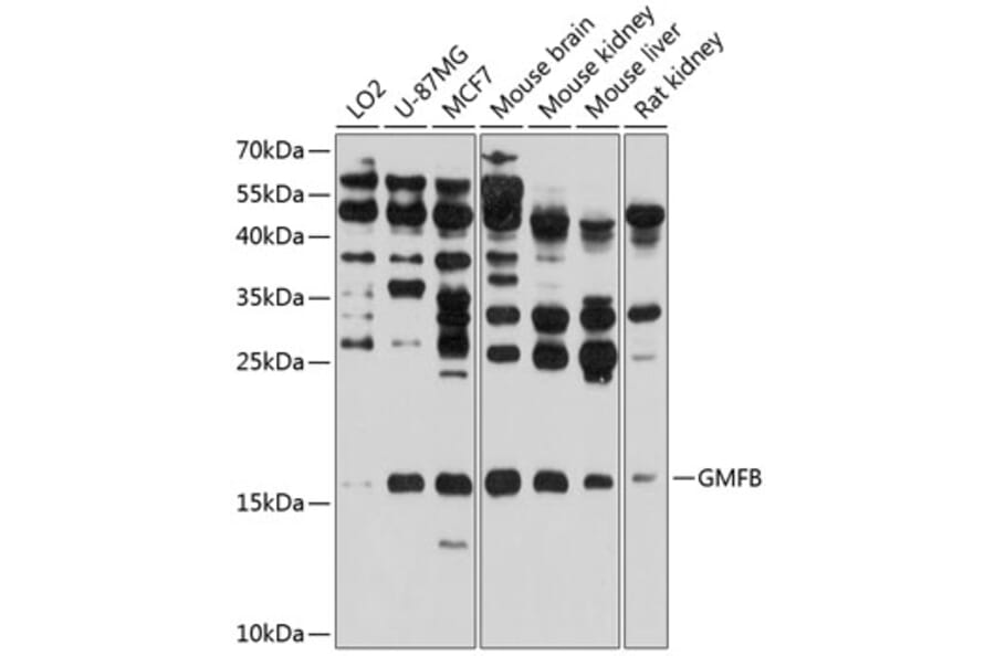 Western Blot - Anti-GMFB Antibody (A16256) - Antibodies.com
