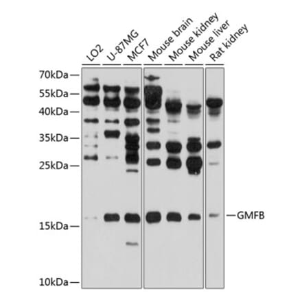 Western Blot - Anti-GMFB Antibody (A16256) - Antibodies.com