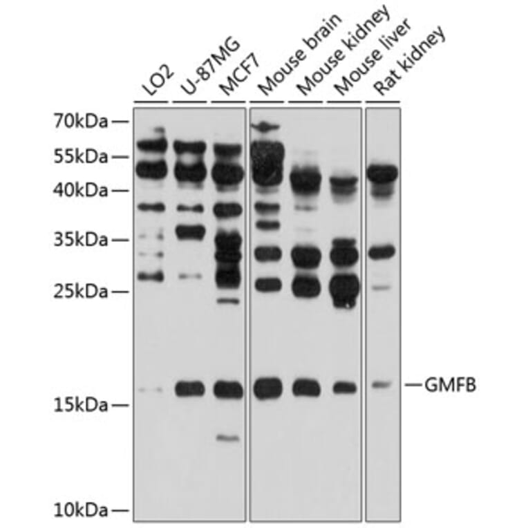 Western Blot - Anti-GMFB Antibody (A16256) - Antibodies.com