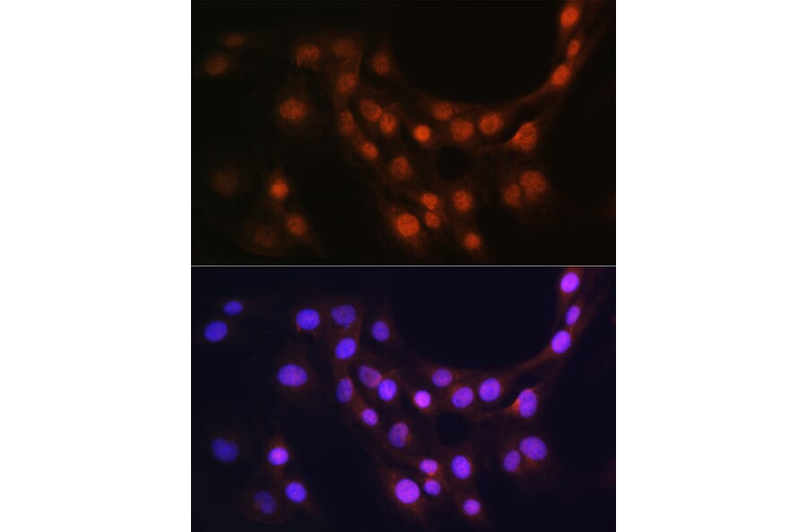 Immunofluorescence - Anti-GMFB Antibody (A16256) - Antibodies.com
