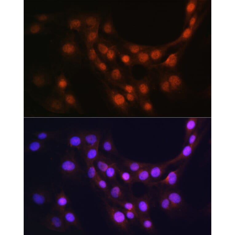 Immunofluorescence - Anti-GMFB Antibody (A16256) - Antibodies.com