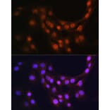 Immunofluorescence - Anti-GMFB Antibody (A16256) - Antibodies.com