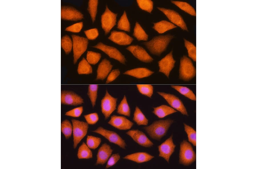 Immunofluorescence - Anti-GMFB Antibody (A16256) - Antibodies.com
