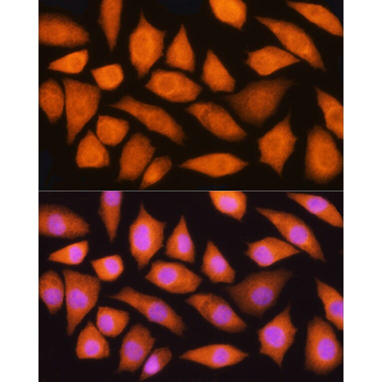 Immunofluorescence - Anti-GMFB Antibody (A16256) - Antibodies.com