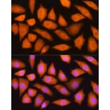 Immunofluorescence - Anti-GMFB Antibody (A16256) - Antibodies.com