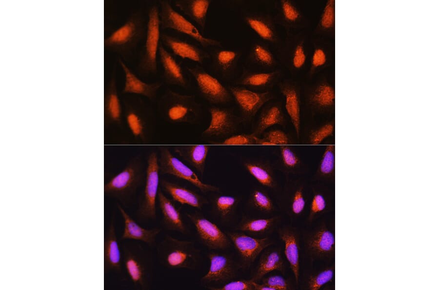 Immunofluorescence - Anti-GMFB Antibody (A16256) - Antibodies.com