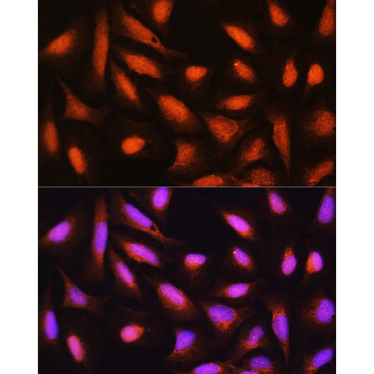 Immunofluorescence - Anti-GMFB Antibody (A16256) - Antibodies.com