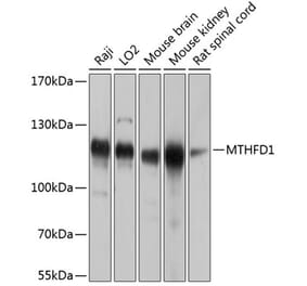 Western Blot - Anti-MTHFD1 Antibody (A16257) - Antibodies.com