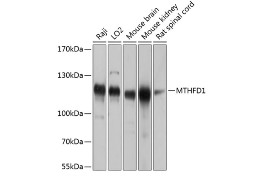 Western Blot - Anti-MTHFD1 Antibody (A16257) - Antibodies.com
