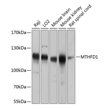 Western Blot - Anti-MTHFD1 Antibody (A16257) - Antibodies.com
