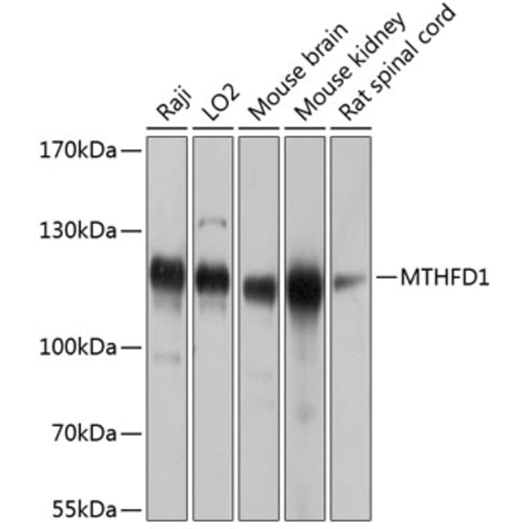 Western Blot - Anti-MTHFD1 Antibody (A16257) - Antibodies.com